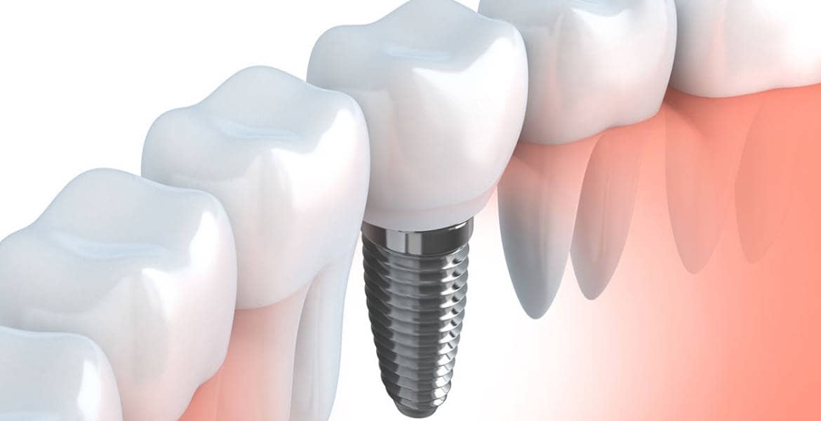 Northland Family Dentistry